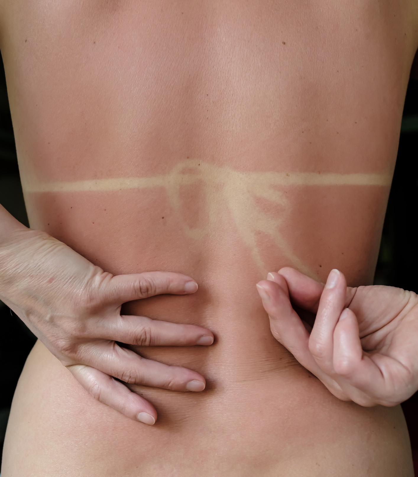 潛入皮膚深處、引發皮膚彈性低下的UVA