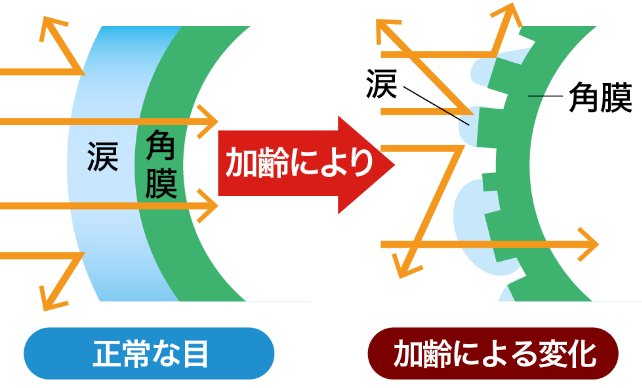 代謝・涙液機能の低下による変化