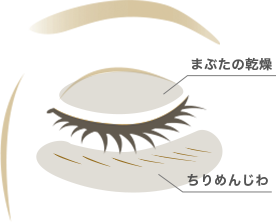 ・ちりめんじわ・まぶたの乾燥