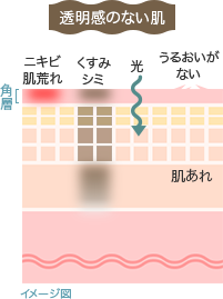 イメージ図：透明感のない肌 肌荒れ くすみ シミ 光 うるおいがない 角層