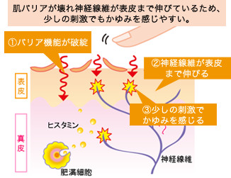 かゆみを感じやすい肌状態図