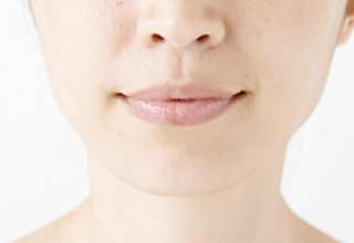 唇のひび割れイメージ