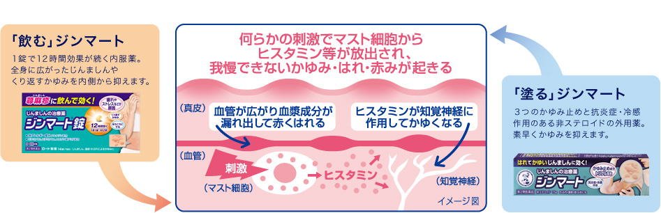 じんましんのはれとかゆみの発生するメカニズム