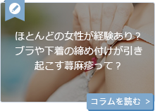ほとんどの女性が経験あり？ブラや下着の締め付けが引き起こす蕁麻疹（しんましん）って…？