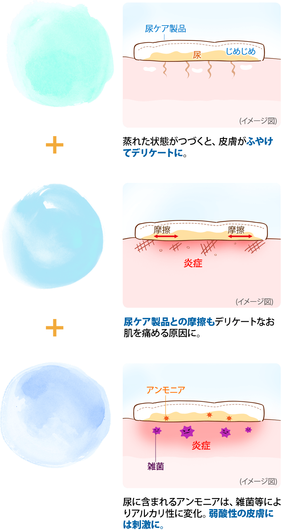 蒸れた状態がつづくと、皮膚がふやけてデリケートに。尿ケア製品との摩擦もデリケートなお肌を痛める原因に。尿に含まれるアンモニアは、雑菌等によりアルカリ性に変化。弱酸性の皮膚には刺激に。