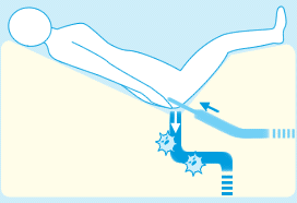 オープンタイプ