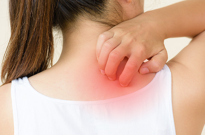 背中のニキビ跡のケア・改善方法