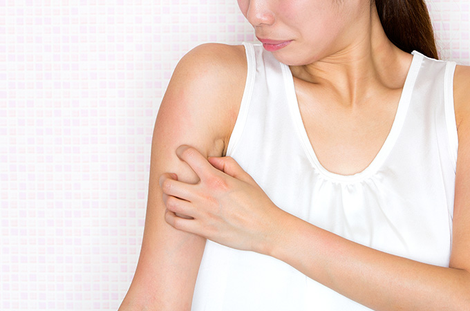 最近増えている！？成人（大人）のアトピー性皮膚炎