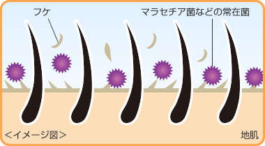 頭皮に潜む常在菌