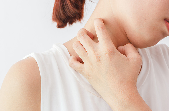 主な蕁麻疹の症状