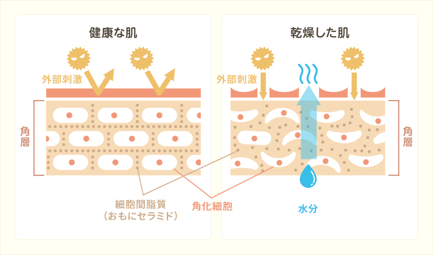 乾燥肌・乾皮症の仕組み
