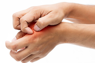 「やけどをしたらアロエを塗れば治る」とよく聞きますが、それは本当ですか？