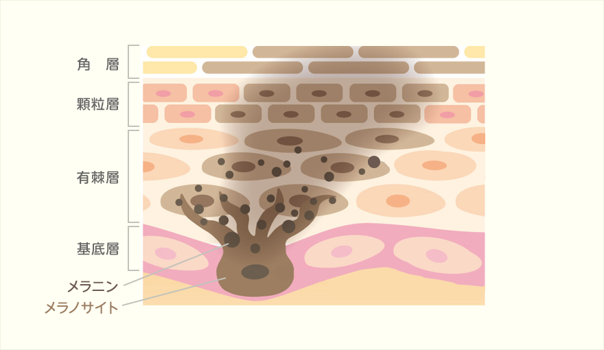 しみができるまでの仕組み