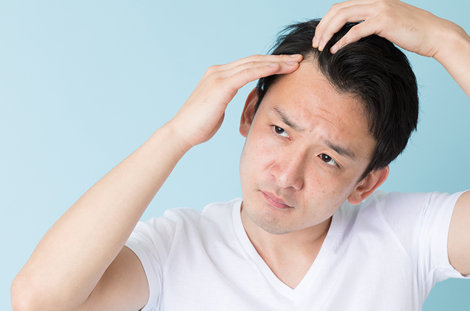 男性が薄毛になる仕組み・主な原因