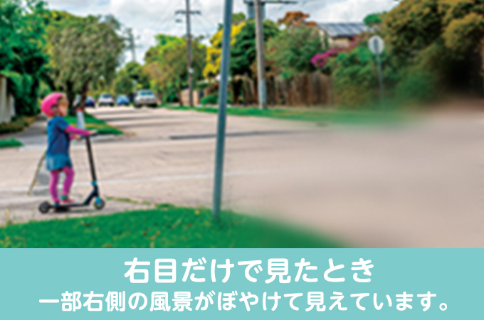右目だけで見たとき（一部右側の風景がぼやけて見えています。）