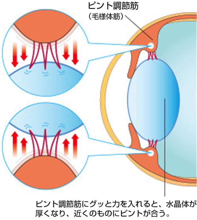 老眼の原因1、ピント調整筋が衰える