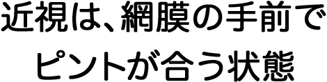 近視は、網膜の手前でピントが合う状態