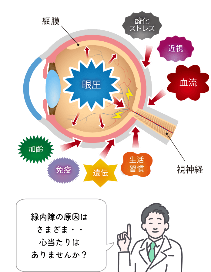 緑内障の原因はさまざま・・・心当たりはありませんか？