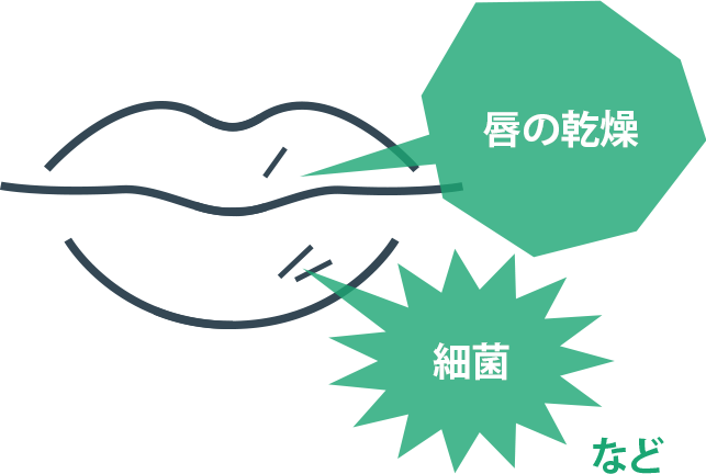 唇の乾燥・細菌など