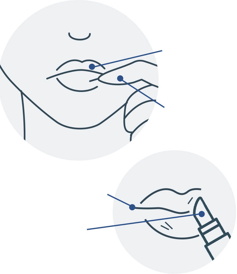 口角炎・口唇炎