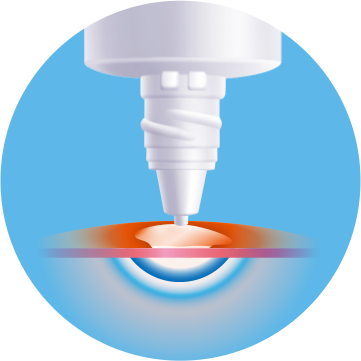 図：耳の周りには直ぬり