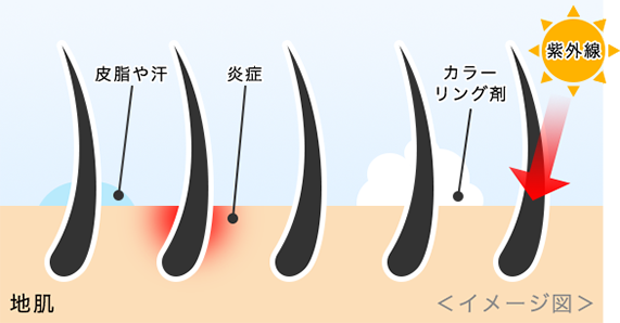 イメージ図：間違ったシャンプーの仕方、紫外線、乾燥などが刺激となり、炎症を引き起こします。