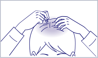 メンソレータム® メディクイック®H ゴールドを塗る