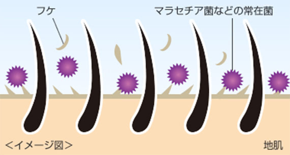 マラセチア菌などの常在菌