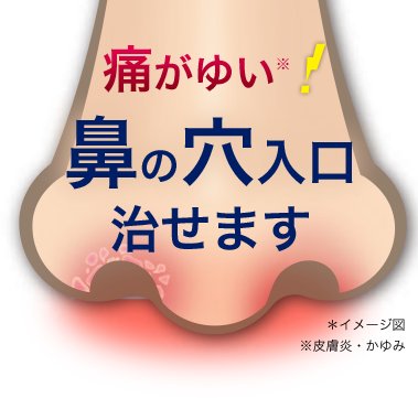 イメージ図：痛がゆい※！鼻の穴入口 治せます※皮膚炎・かゆみ