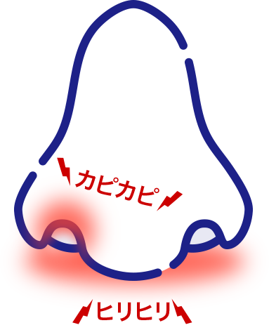 イメージ図：カピカピ、ヒリヒリ