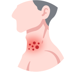 赤みを伴う湿疹