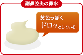 副鼻腔炎の鼻水：黄色っぽくドロッとしている