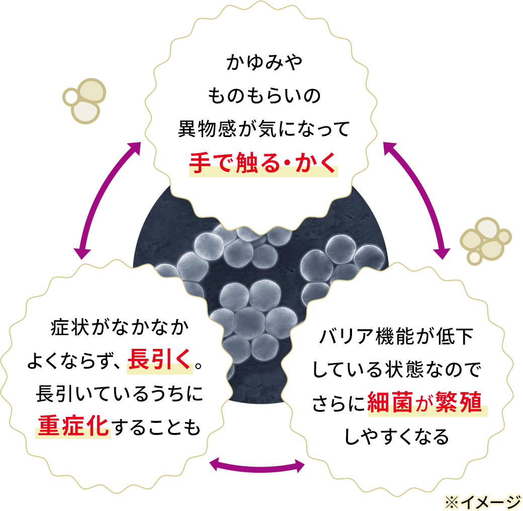 かゆみやものもらいの異物感が気になって手で触る・かく、バリア機能が低下している状態なのでさらに細菌が繁殖しやすくなる、症状がなかなかよくならず、長引く。長引いているうちに重症化することも
