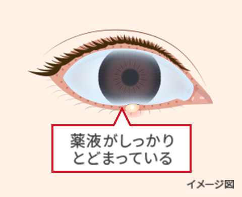 薬剤がしっかりとどまっている
