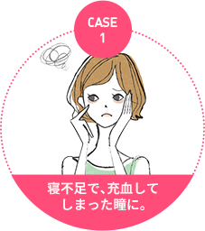 case1：寝不足で、 充血してしまった瞳に。