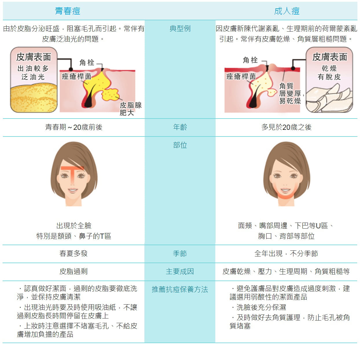 青春痘與成人痘的區別