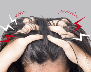 有一種頭癢叫做“頭皮濕疹”