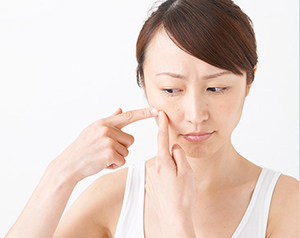 「ニキビ」の原因や種類、症状を解説