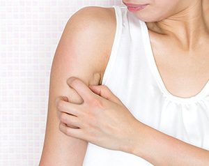 「虫刺され」の原因・症状を解説