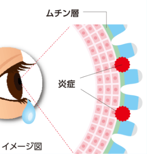 角膜が露出すると炎症が起こりやすくなり、その炎症の結果、涙が過剰に分泌されます。これがなみだ目症状です。