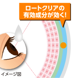 プラノプロフェンがなみだ目の原因である炎症を抑えます。